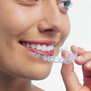 Choosing Invisalign in Las Vegas: A Comprehensive Guide